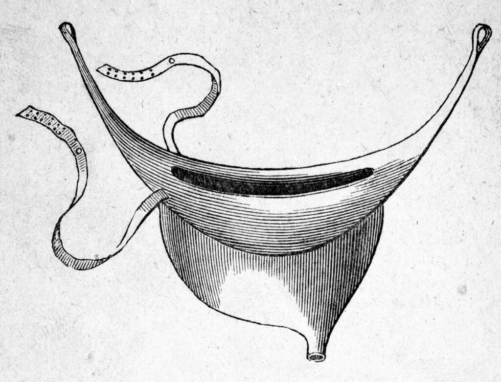 The mysteries of the travelling urinal... - Buzzers for Bedwetters ...