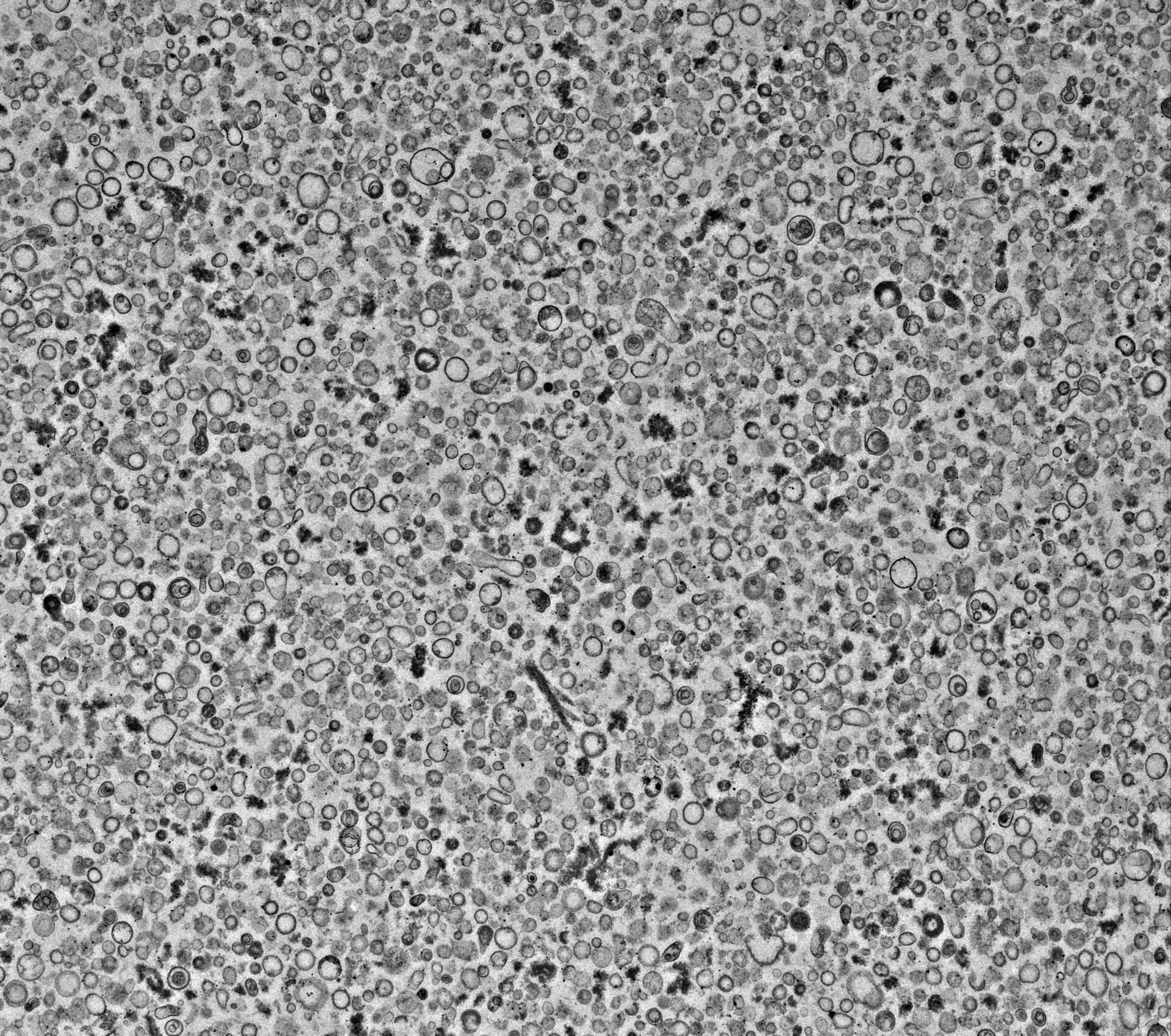EM image of vesicles