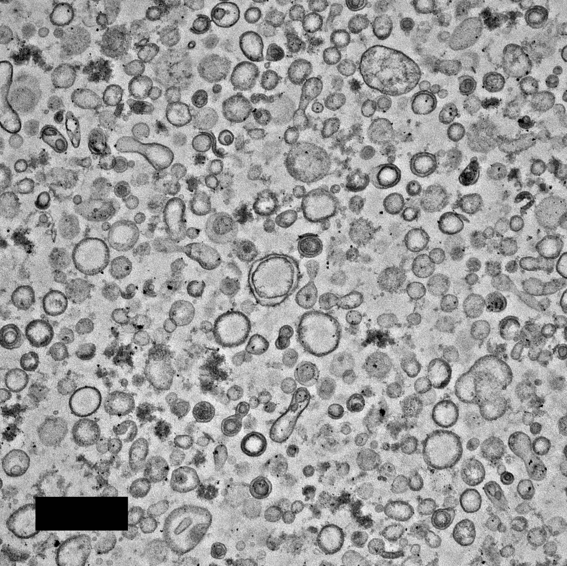 EM image of vesicles